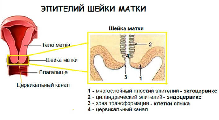 воспалительный тип мазка